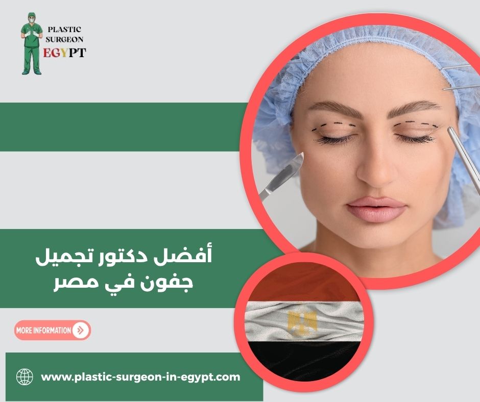 أفضل دكتور تجميل جفون في مصر