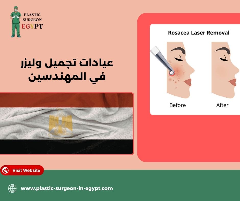 افضل عيادات ليزر في المهندسين