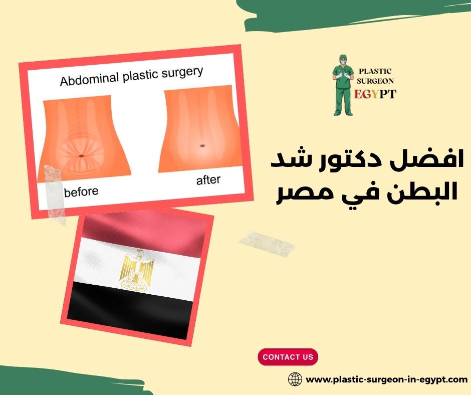 افضل دكتور شد البطن في مصر