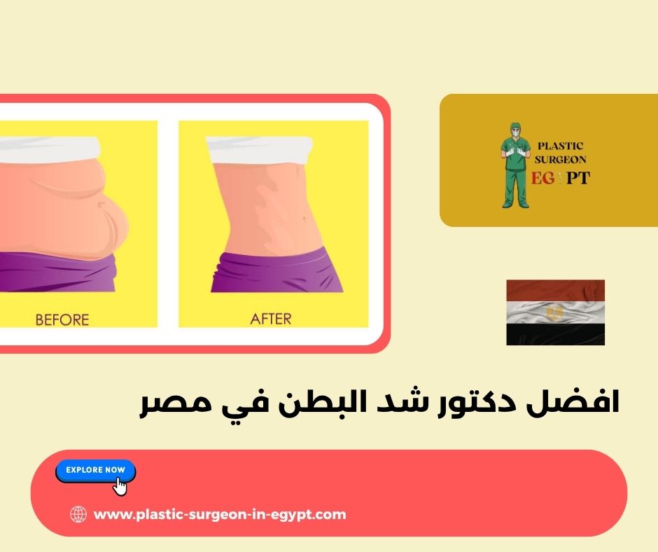 افضل دكتور شد البطن في مصر