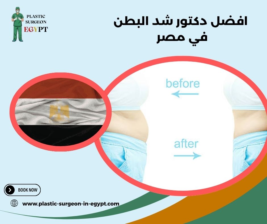 أفضل دكتور شد البطن في مصر
