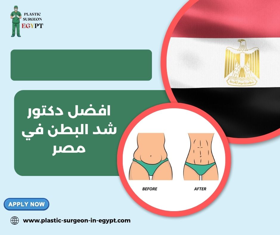 دكتور شد البطن في مصر