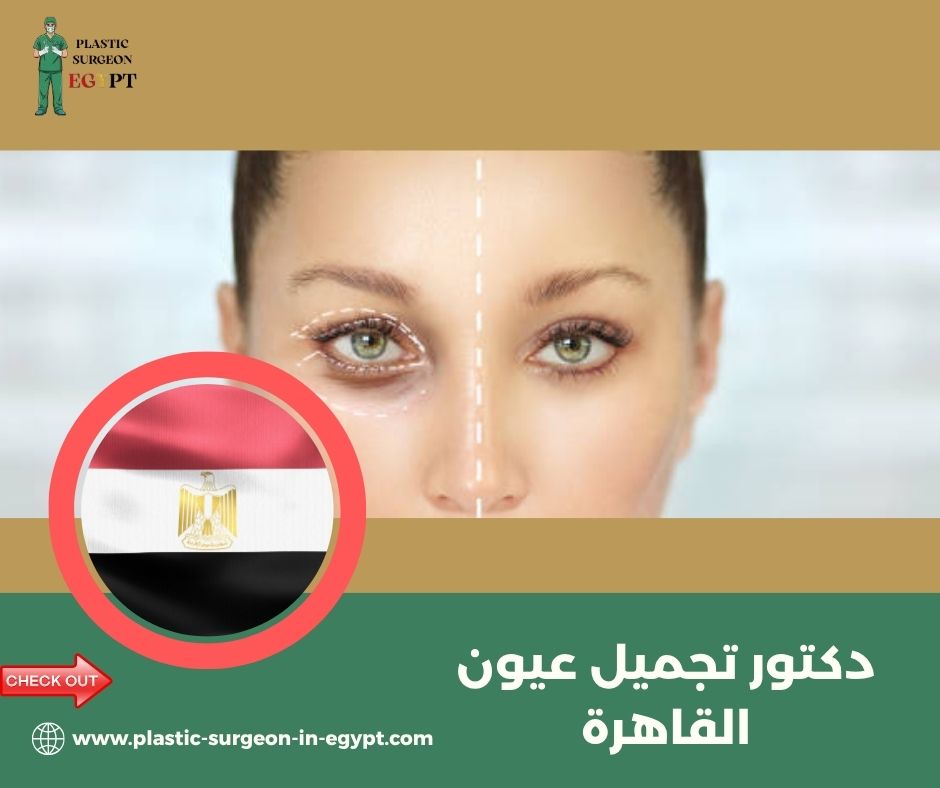 دكتور تجميل عيون القاهرة