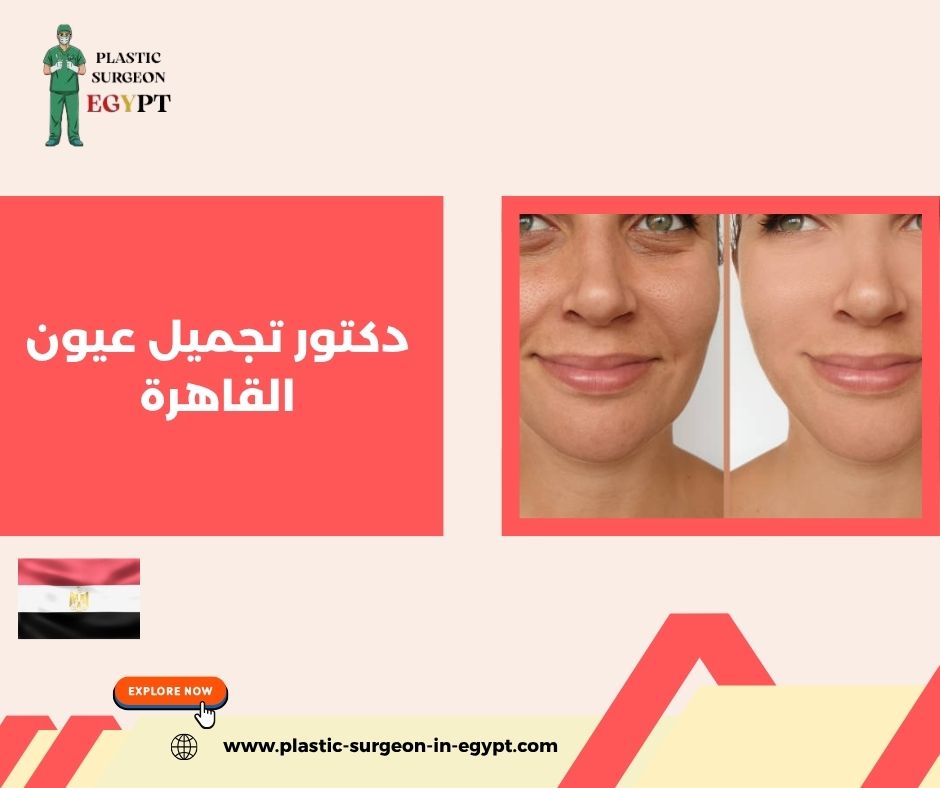 دكتور تجميل عيون القاهرة