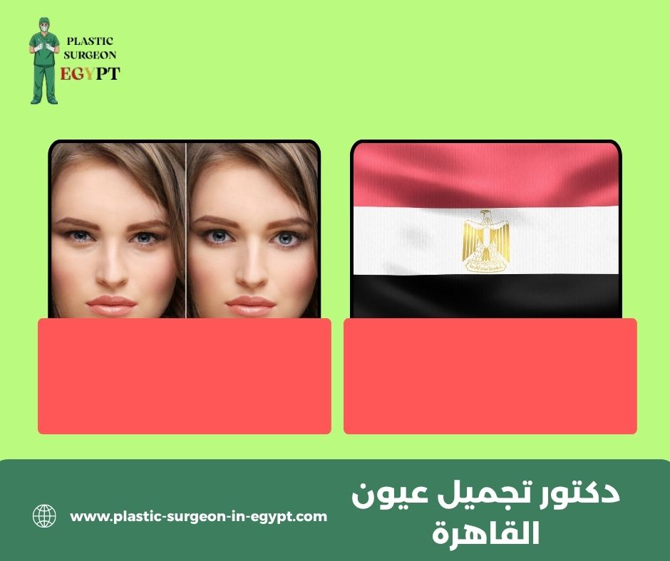 جراح تجميل عيون