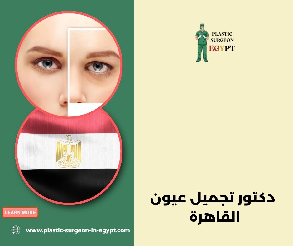دكتور تجميل عيون الإسكندرية
