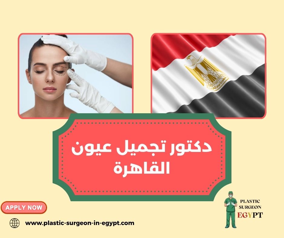 دكتور تجميل عيون القاهرة