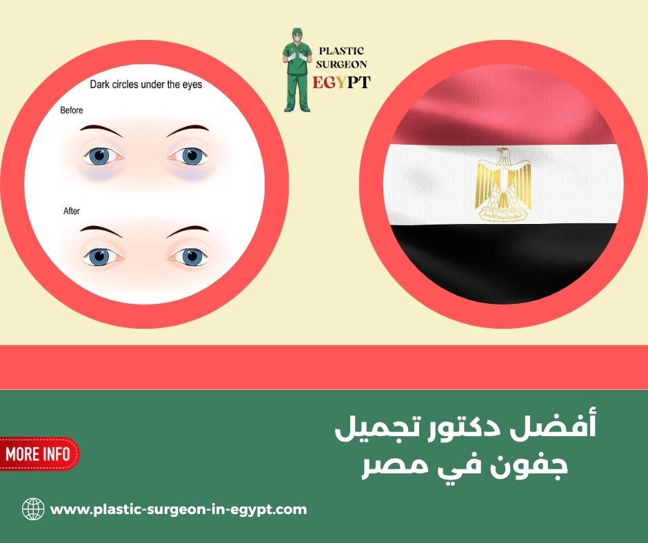 أفضل دكتور تجميل جفون في مصر