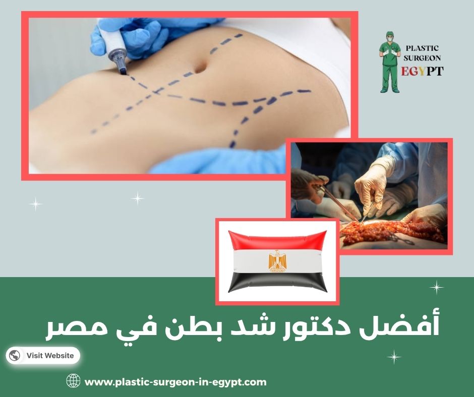 أفضل دكتور شفط دهون بالفيزر في مصر