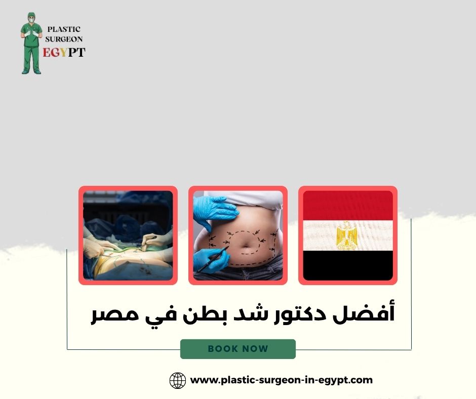 أفضل دكتور شد بطن في مصر