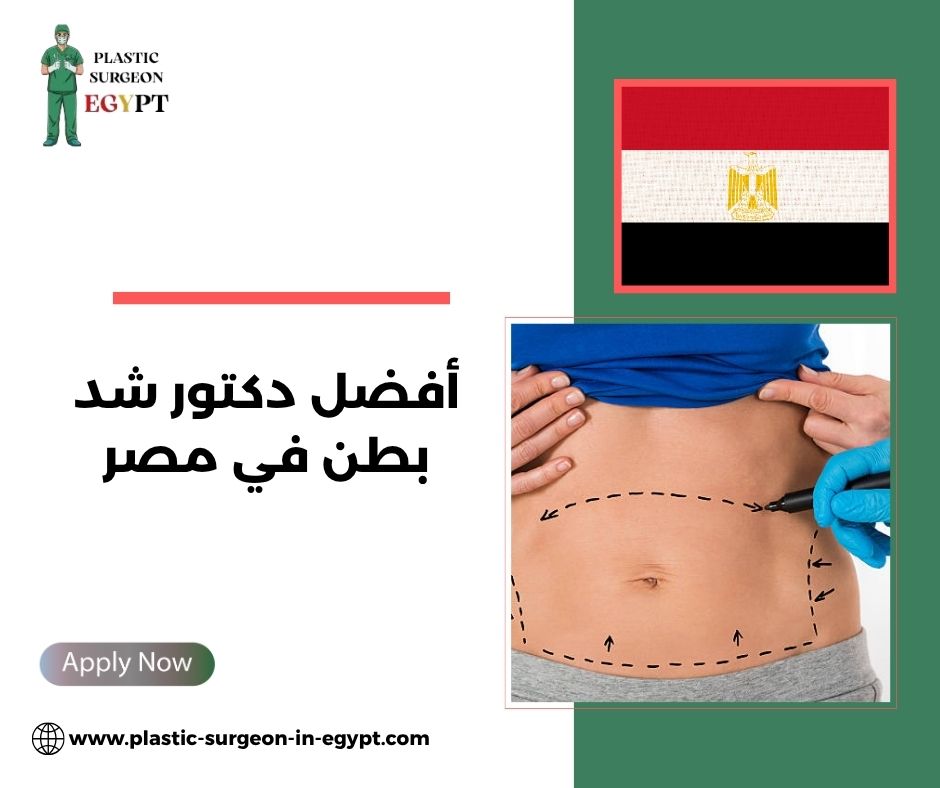 أفضل دكتور شد بطن في مصر