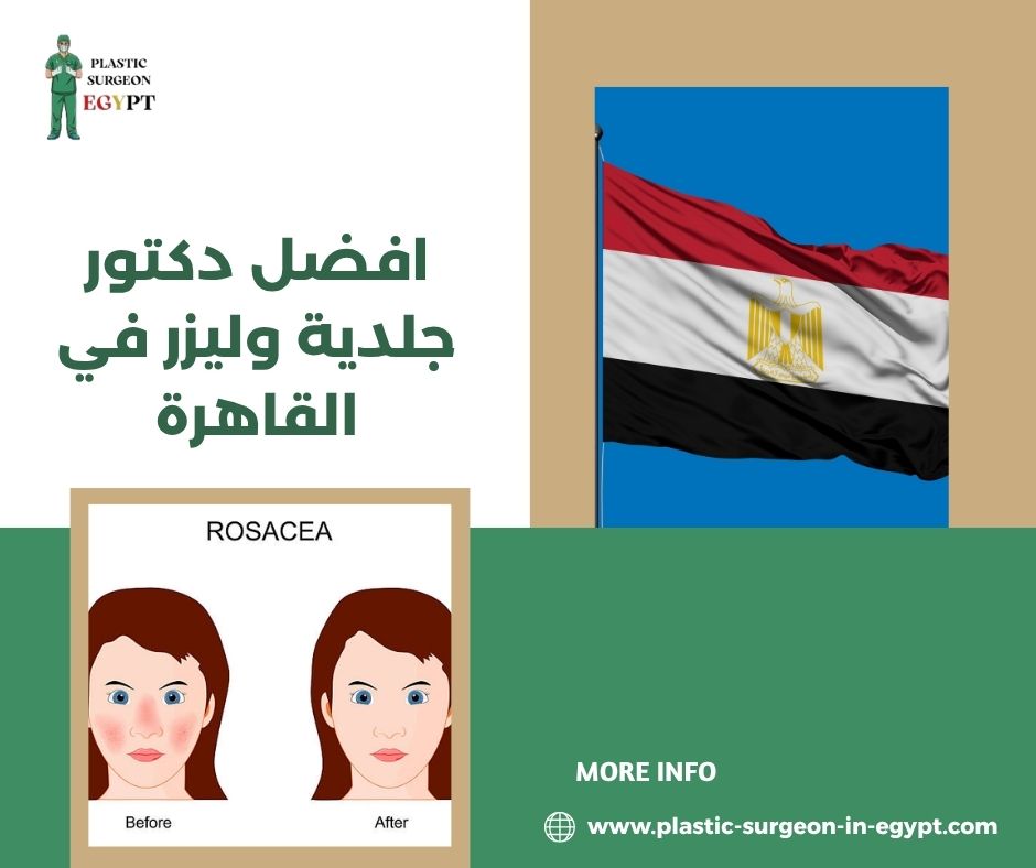 افضل دكتور جلدية في مصر الجديدة