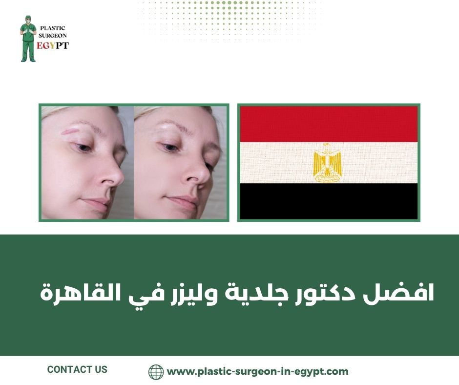 افضل دكتور جلدية وليزر في القاهرة