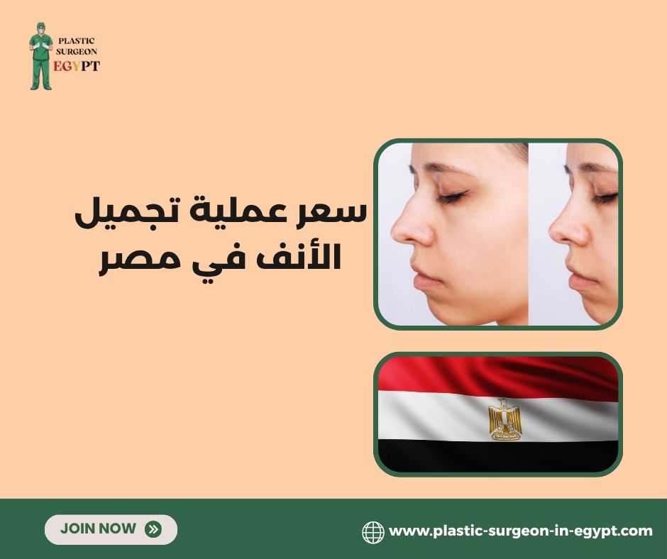 سعر عملية تجميل الأنف في مصر سعر عملية تجميل الأنف في مصر