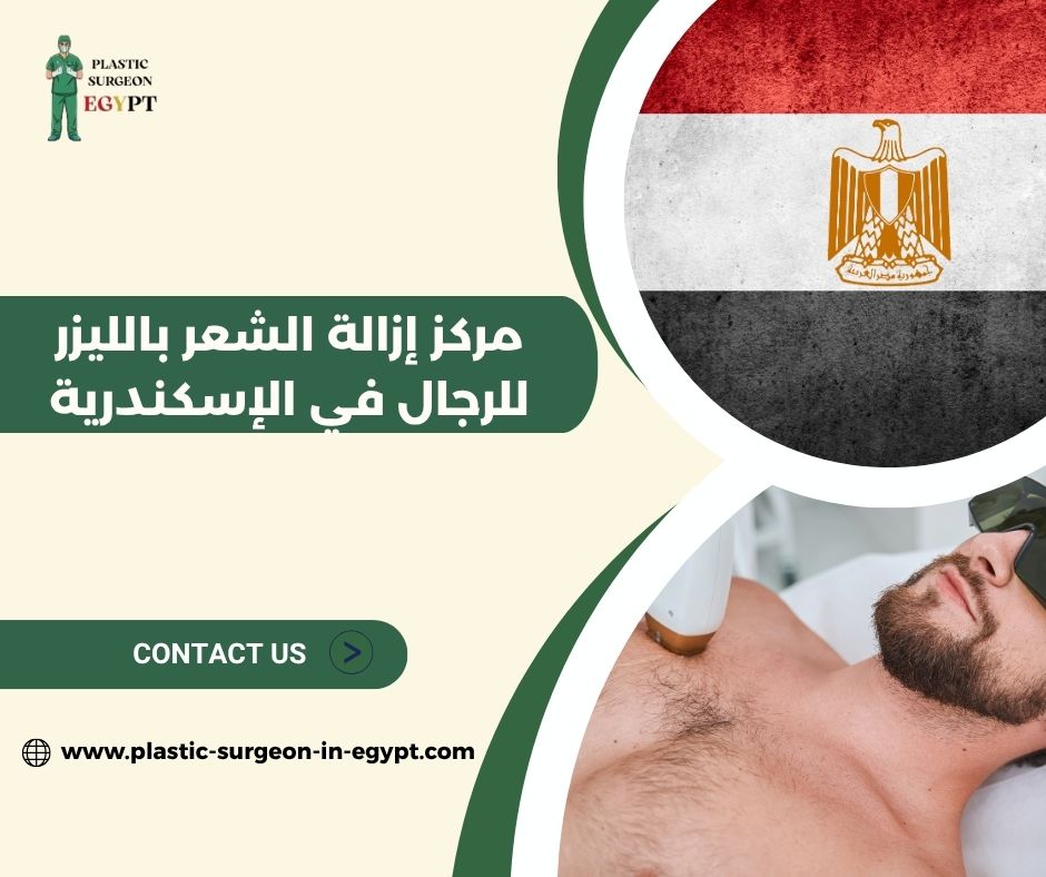 مركز إزالة الشعر بالليزر للرجال في الإسكندرية