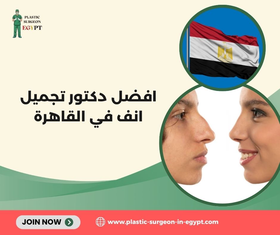 مين احسن دكتور تجميل انف في مصر