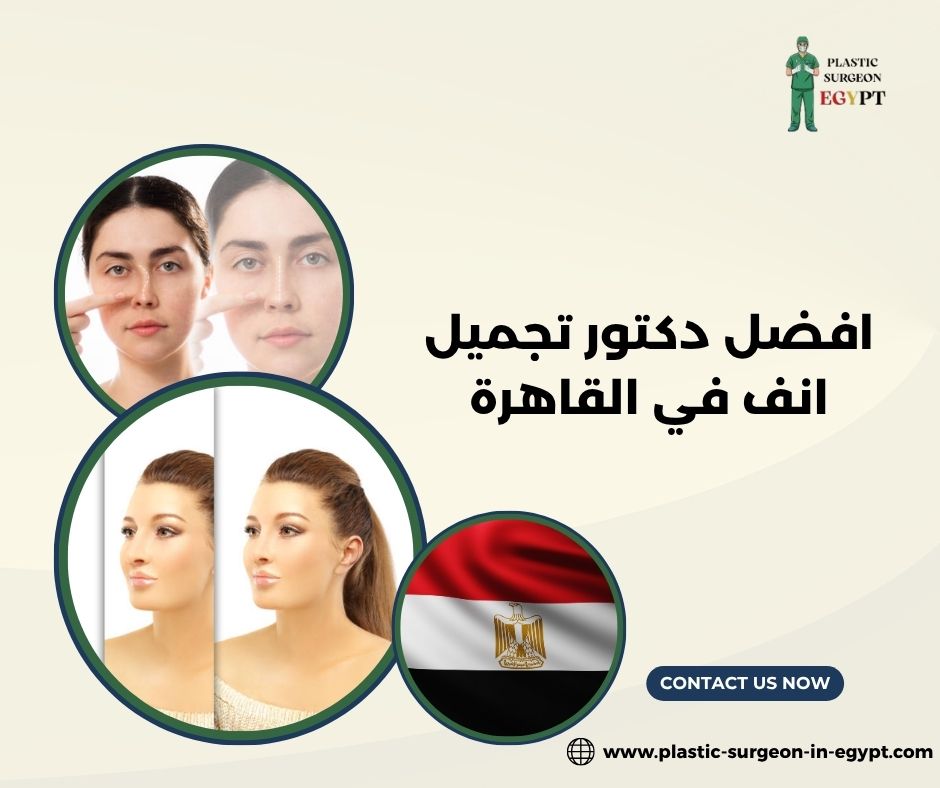 افضل دكتور تجميل انف في القاهرة