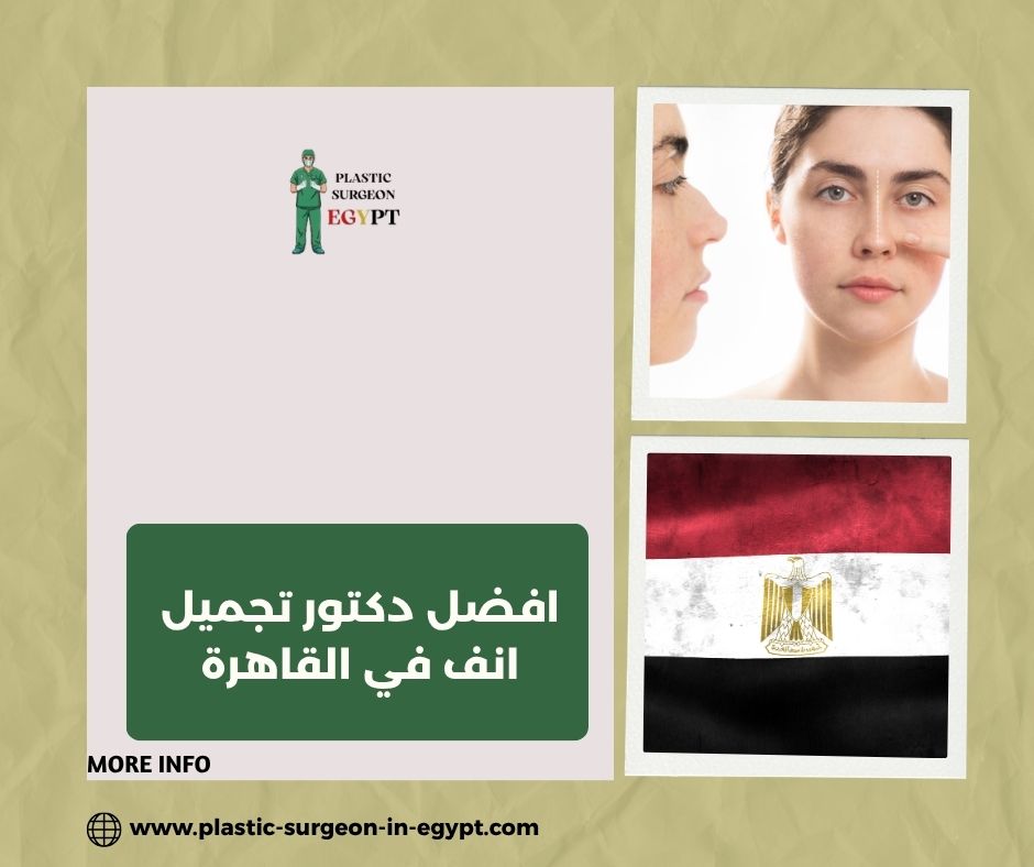 افضل دكتور تجميل انف في القاهرة افضل دكتور تجميل انف في القاهرة