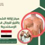 مركز إزالة الشعر بالليزر للرجال في الإسكندرية