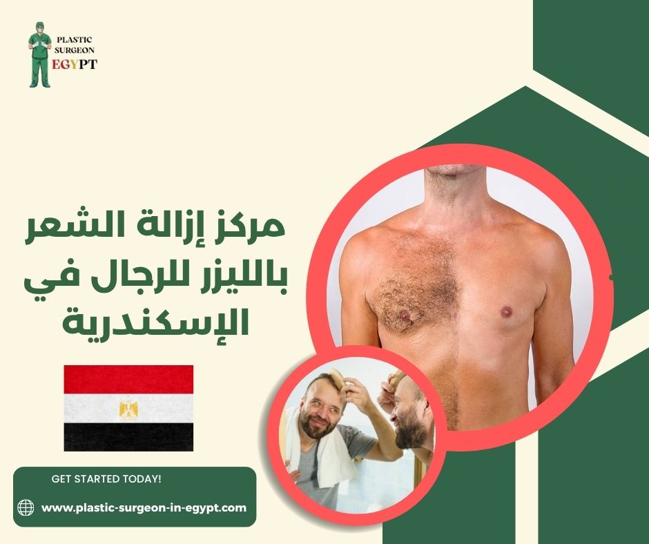 مركز إزالة الشعر بالليزر للرجال في الإسكندرية