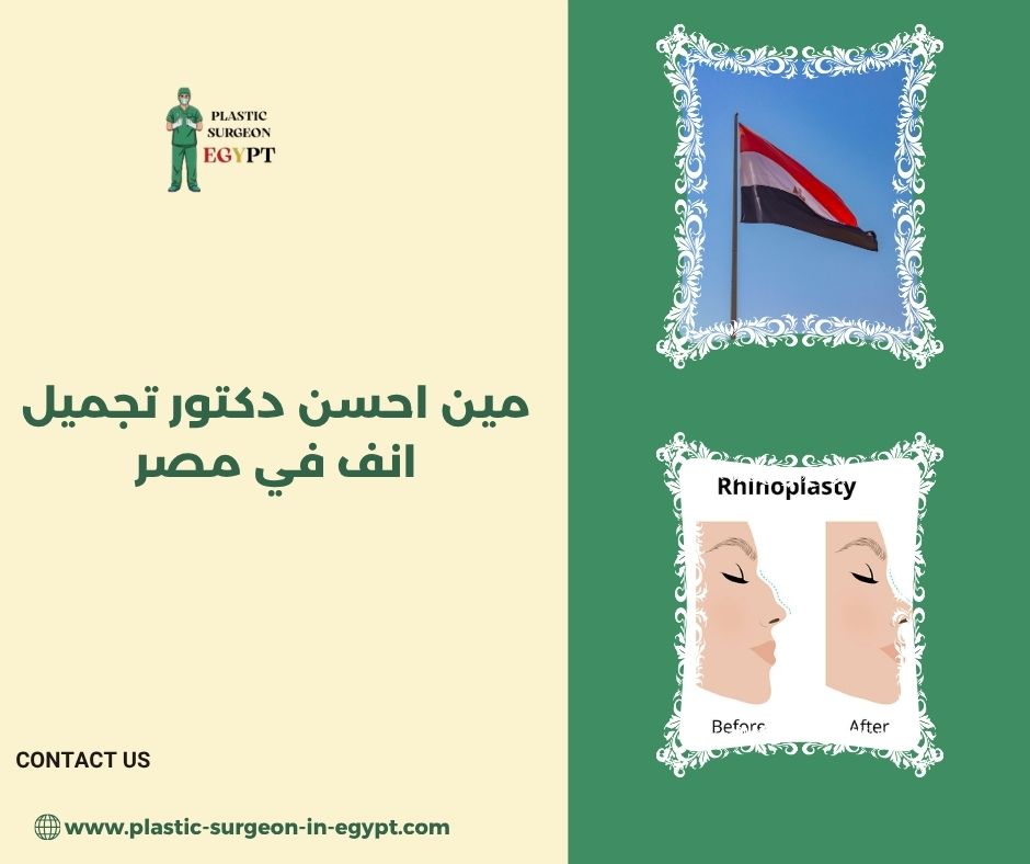 افضل دكتور تجميل في مصر