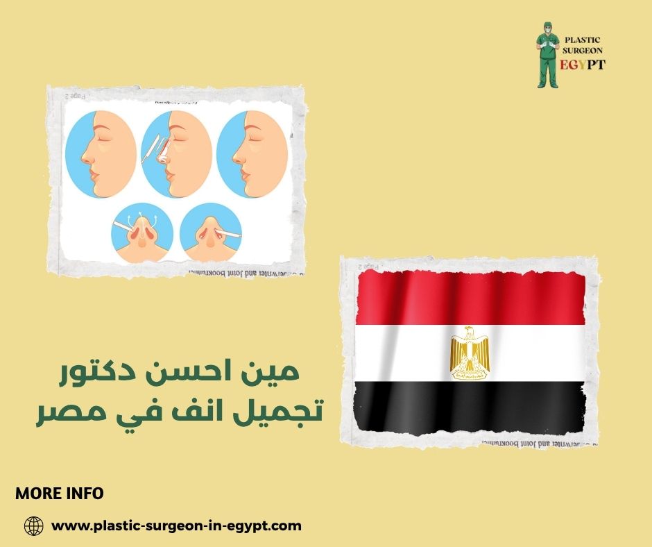 مين احسن دكتور تجميل انف في مصر