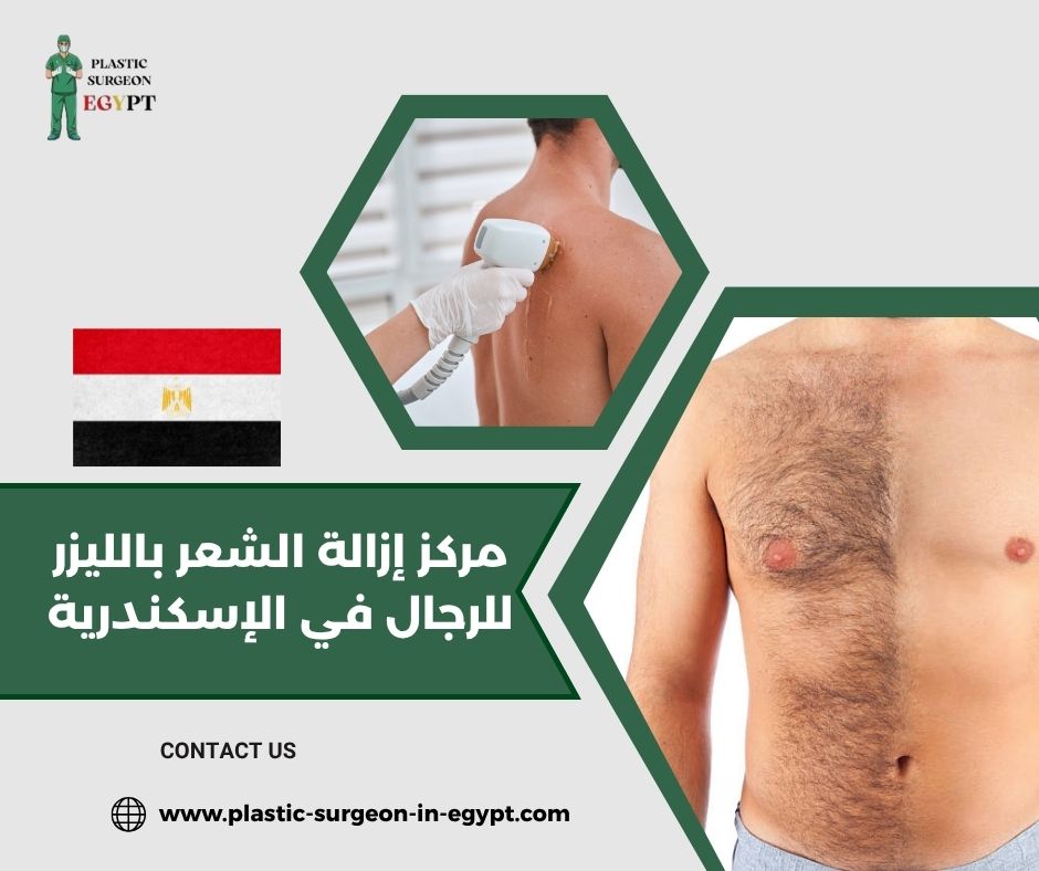 مركز إزالة الشعر بالليزر للرجال في الإسكندرية