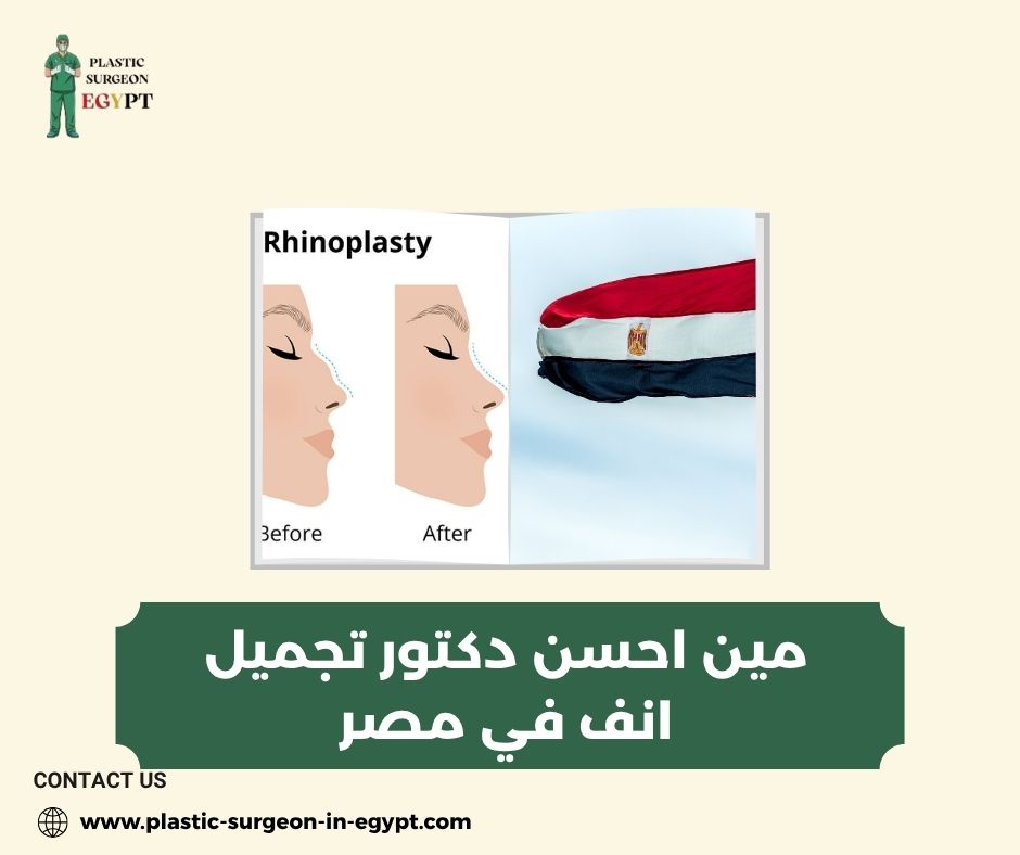 مين احسن دكتور تجميل انف في مصر