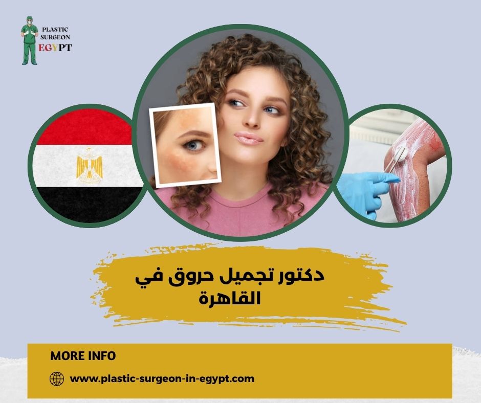 دكتور تجميل حروق في القاهرة