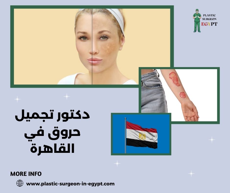 دكتور تجميل انف في القاهرة