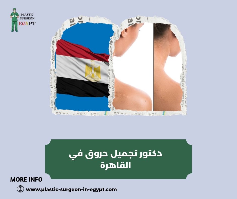دكتور تجميل حروق في القاهرة