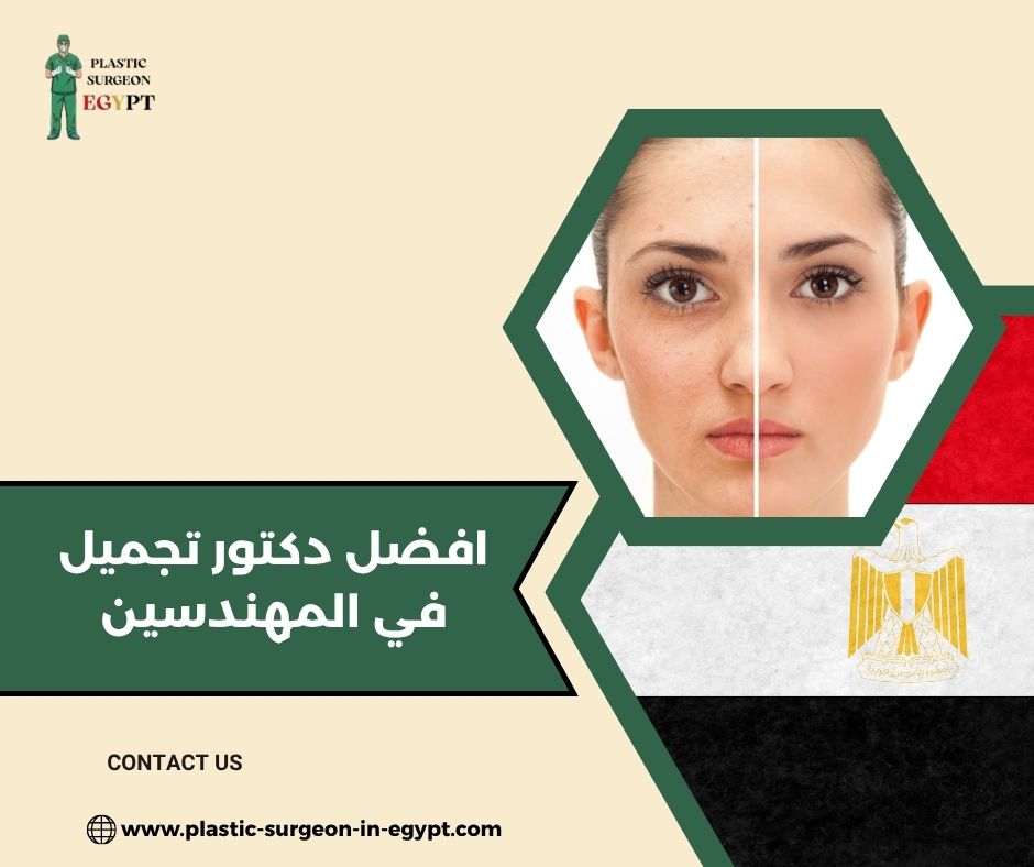 افضل دكتور تجميل في المهندسين